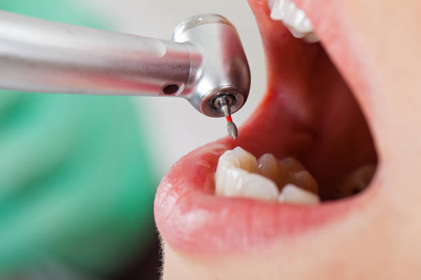 Best Walk-In Emergency Dentist in Daniel, UT